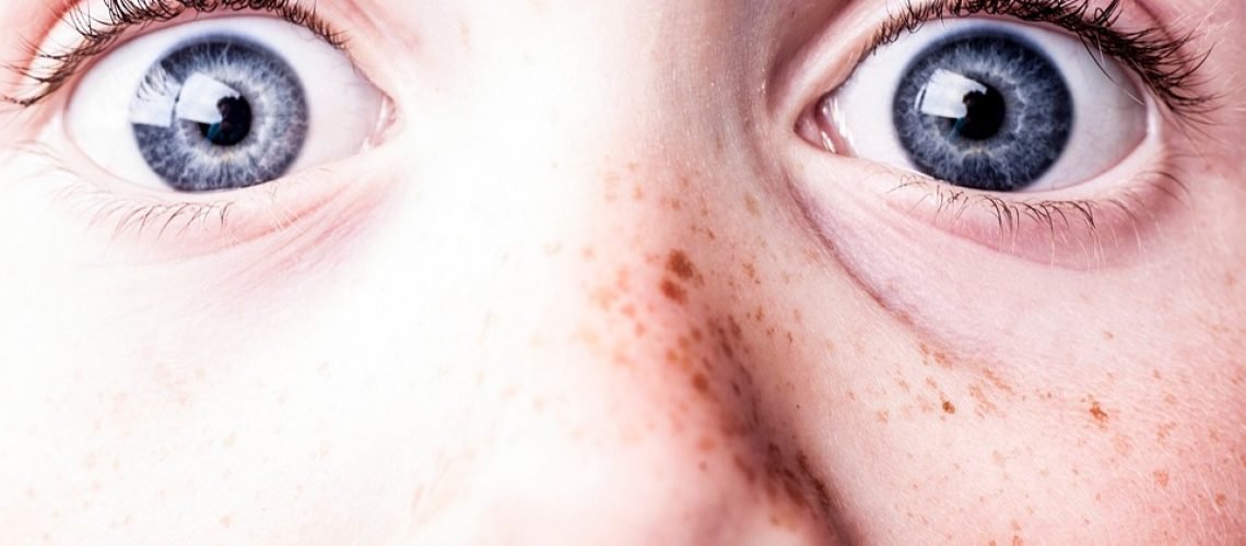 surprised-1327192_960_720